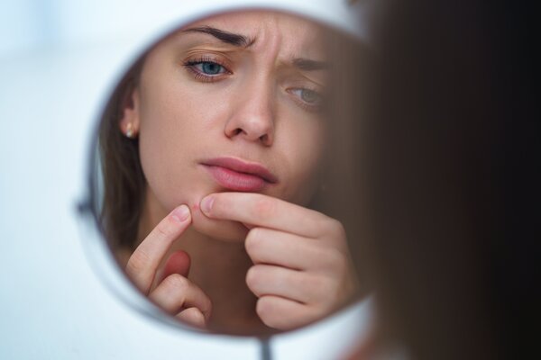 ACNE SCARS - WHAT IS THE BEST TREATMENT?